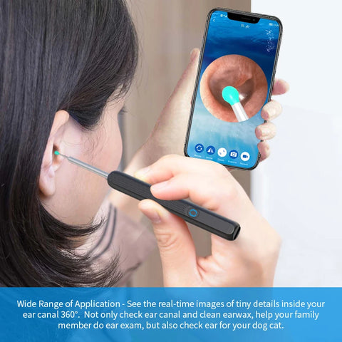 Ear Cleaner High Precision | Ear Wax Removal Tool with Camera LED Light Wireless Otoscope Smart Ear Cleaning Kit
